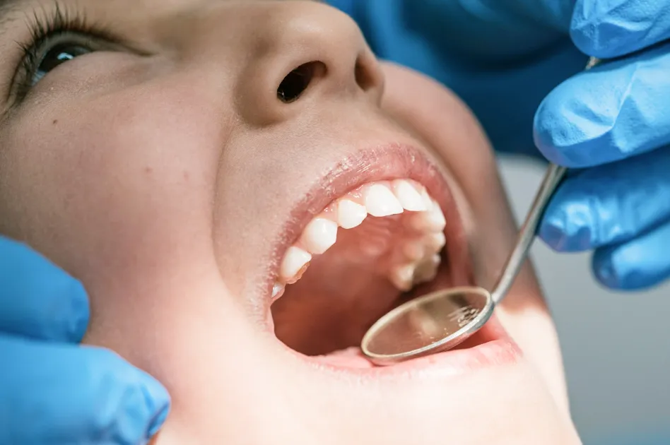Dental examination