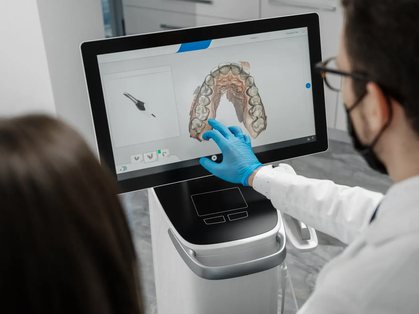 Dentist wearing blue gloves pointing at a 3D digital scan of upper teeth on a touchscreen monitor.