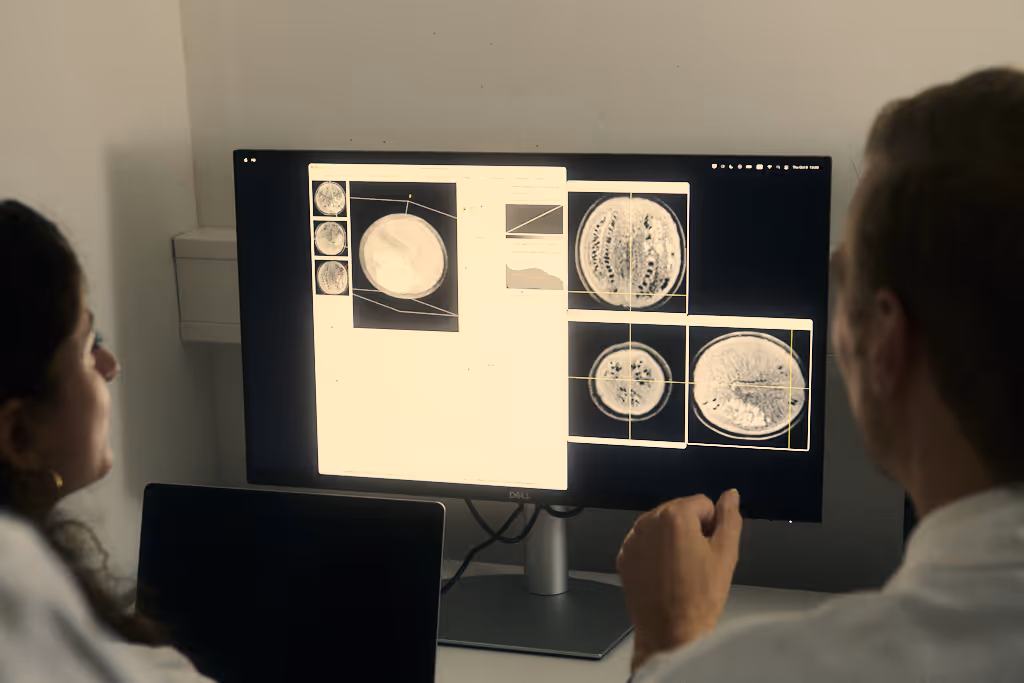 Two people looking at brain scan images displayed on a computer monitor in a dimly lit room.