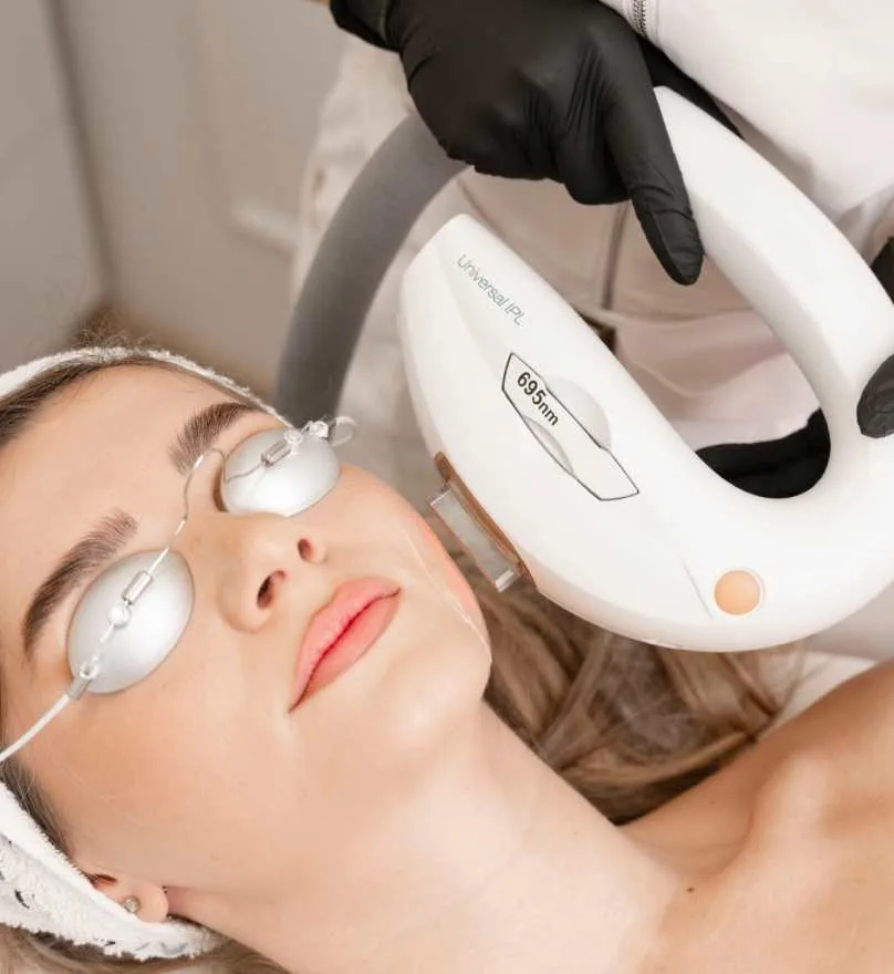 Tratament facial cu laser Stellar M22 pentru rejuvenarea și uniformizarea tenului