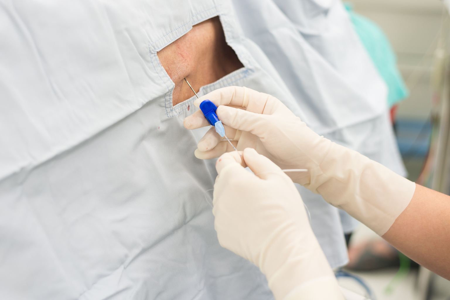 Caudal Epidural Injections: What Patients Need to Know