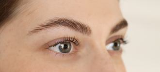 Brow lift