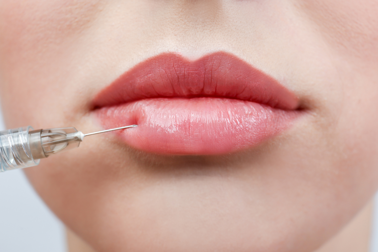 Can You Drink Alcohol After Lip Filler? Everything You Need to Know