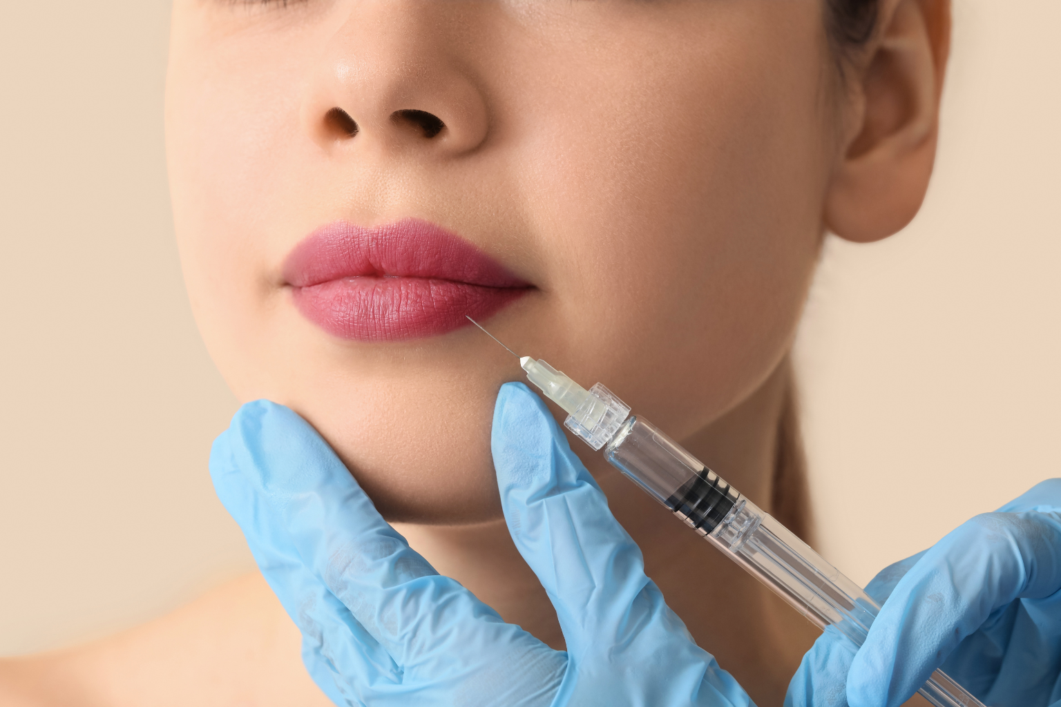 Lip Filler in Hertfordshire: What to Look for in a Provider