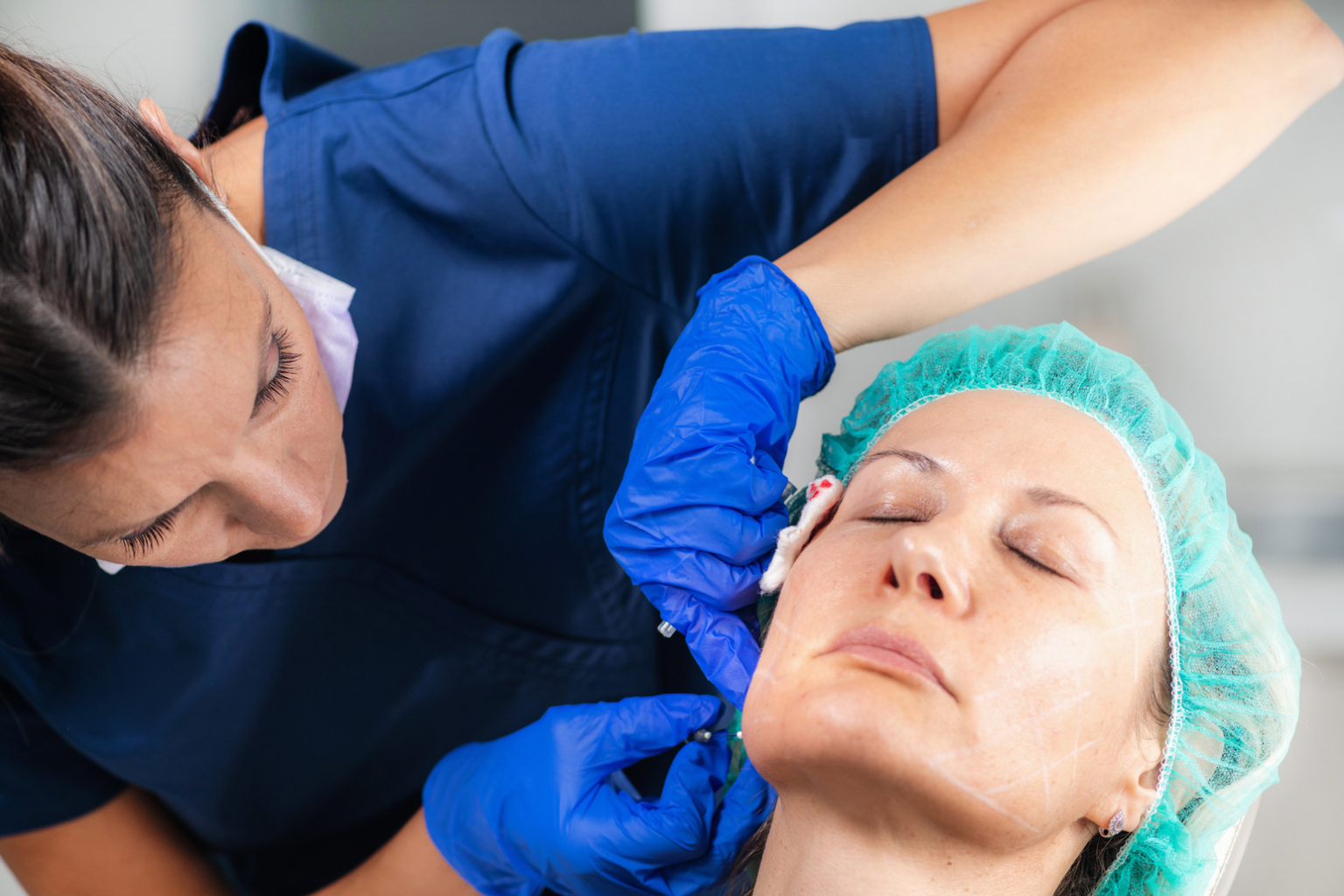 Lower-Face Filler for Jowls and Sagging: What's Possible Without Surgery?