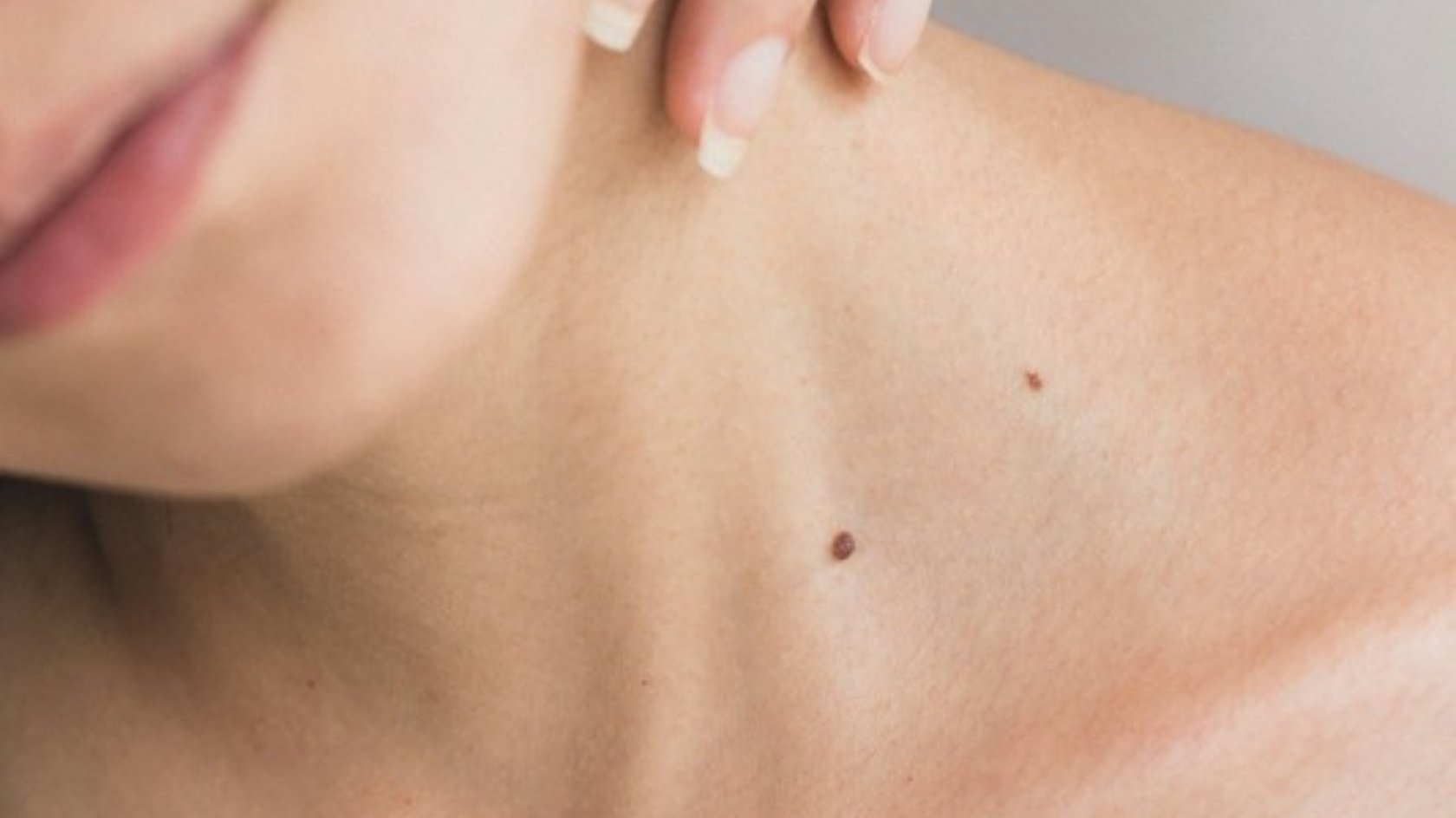 Close-up of a woman's neck and collarbone with two small moles