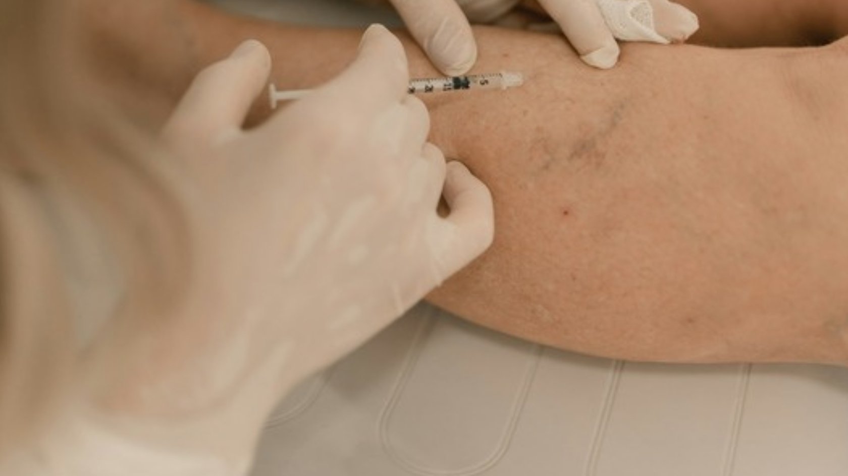Clinician in gloves numbing the skin with local anaesthetic before a minor skin procedure