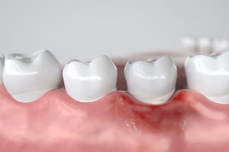 Discover the Art of Healthy Smiles with a Dentist in Missoula MT