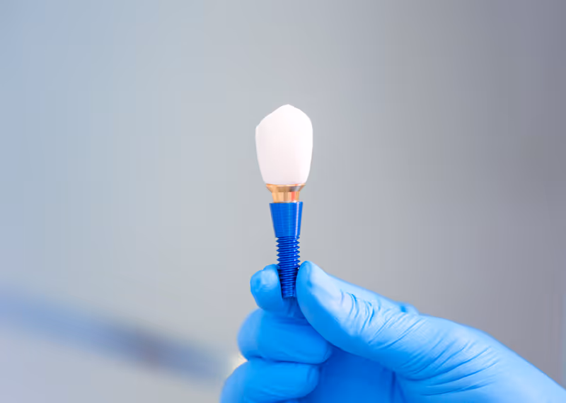 Understanding Abutment Implants: An In-Depth Guide to Dental Implants