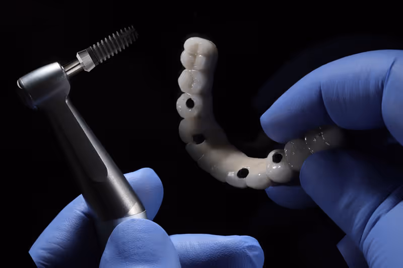 Unveiling the Benefits of Dental Implants in Clinton, MT