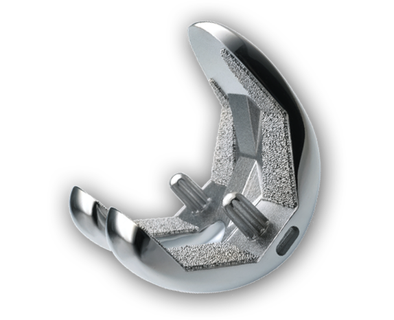 Femoral orthopaedic components