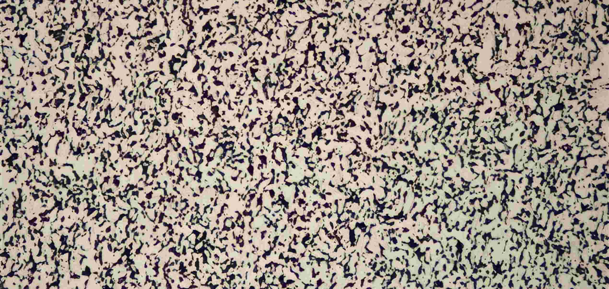 Controlled Grain Flow in Orthopaedic Forging