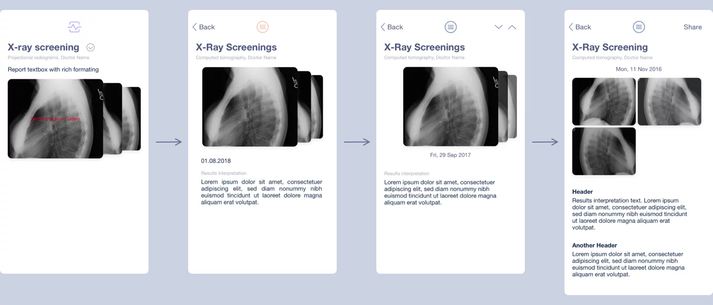 Incremental design steps of X-Ray screens, illustrating the interface design evolution