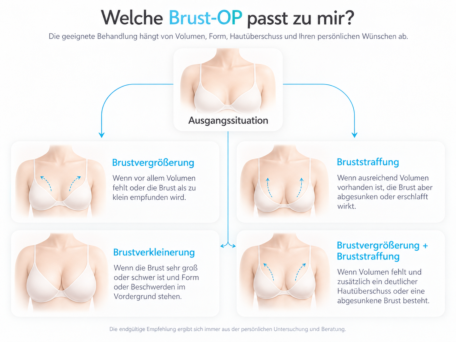 Übersicht zur Wahl einer Brustoperation: Brustvergrößerung, Bruststraffung, Brustverkleinerung und kombinierte Vergrößerung mit Straffung.