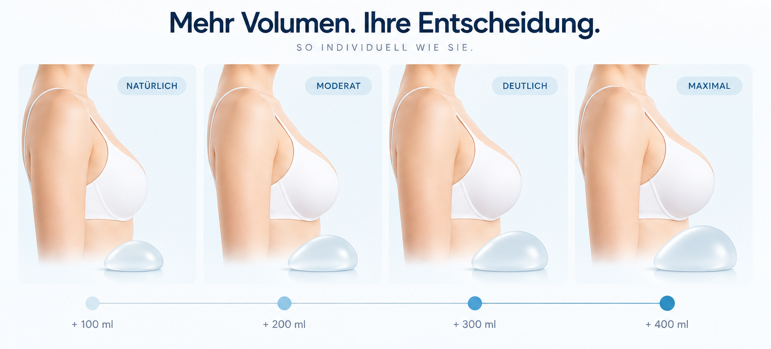 Schematischer Vergleich der Brustform bei unterschiedlich großen Implantatvolumina in der Seitenansicht.