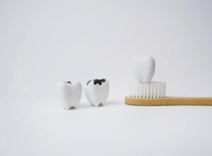 5 Reasons Why Tooth Decay Is Nothing to Smile About