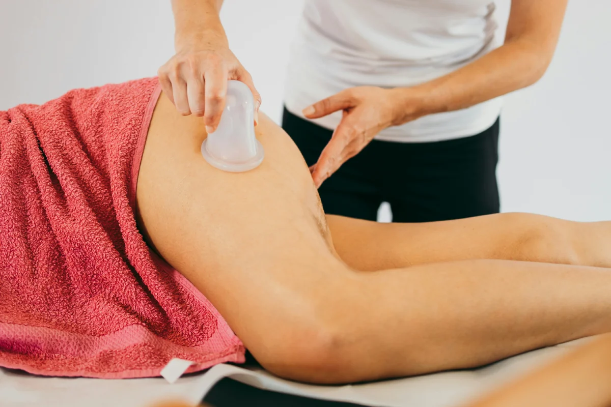 cupping massage cellulitis