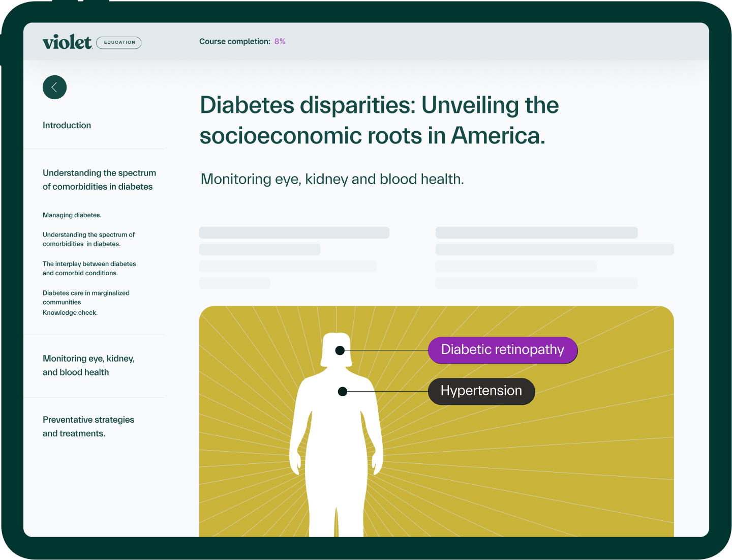 Online course page titled 'Diabetes disparities: Unveiling the socioeconomic roots in America' showing sections on monitoring eye, kidney, and blood health with a diagram highlighting diabetic retinopathy and hypertension.