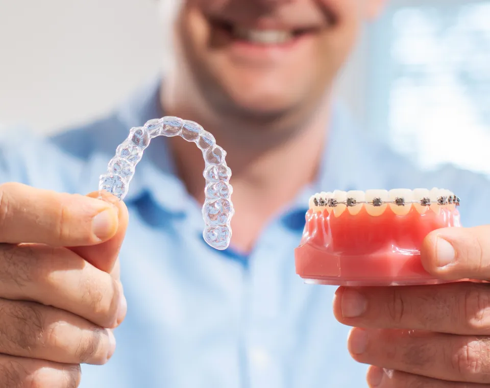 Elegir el Tratamiento de Ortodoncia Correcto: Brackets vs. Alineadores en Iztapalapa, CDMX