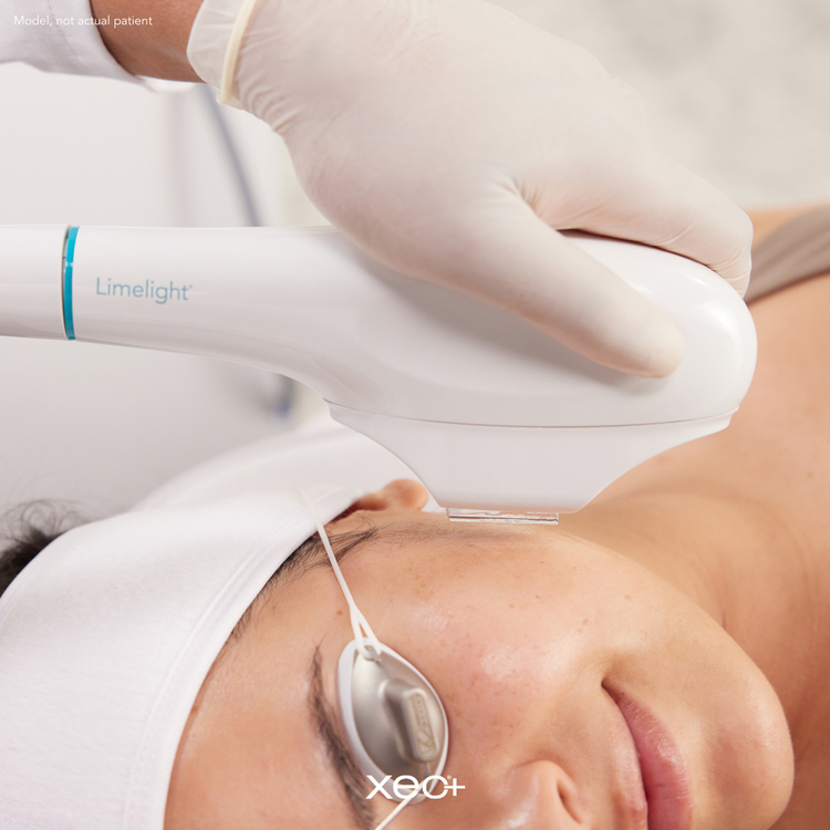 A gloved hand holds a Limelight device near a woman's cheek during a facial treatment; she wears protective eye covers and a white headband.