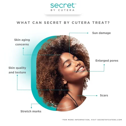 Infographic showing skin concerns treated by Secret by Cutera: sun damage, enlarged pores, scars, stretch marks, skin quality and texture, and skin aging concerns, with a smiling woman with curly hair in the background.