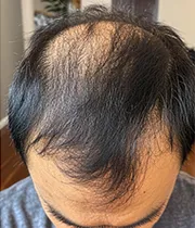 After Image