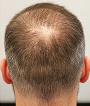 After Image