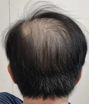 After Image