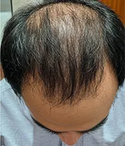 After Image