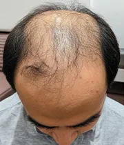 Before Image