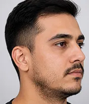 Before Image