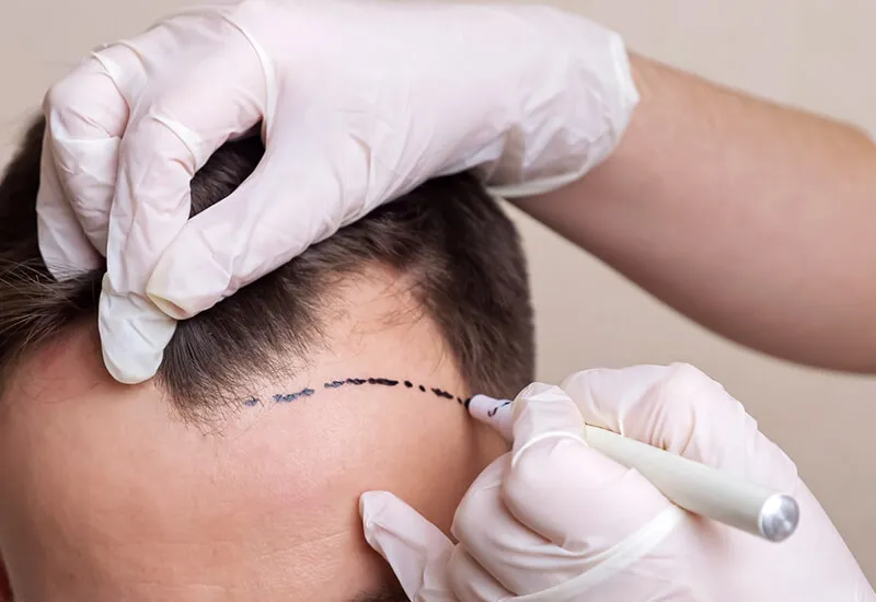 Treatments Image