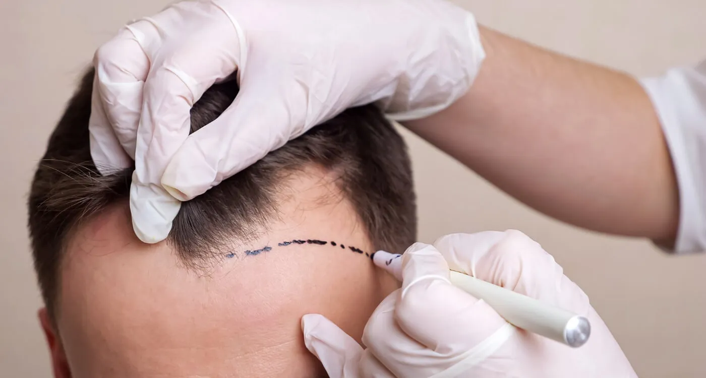 Treatments Image