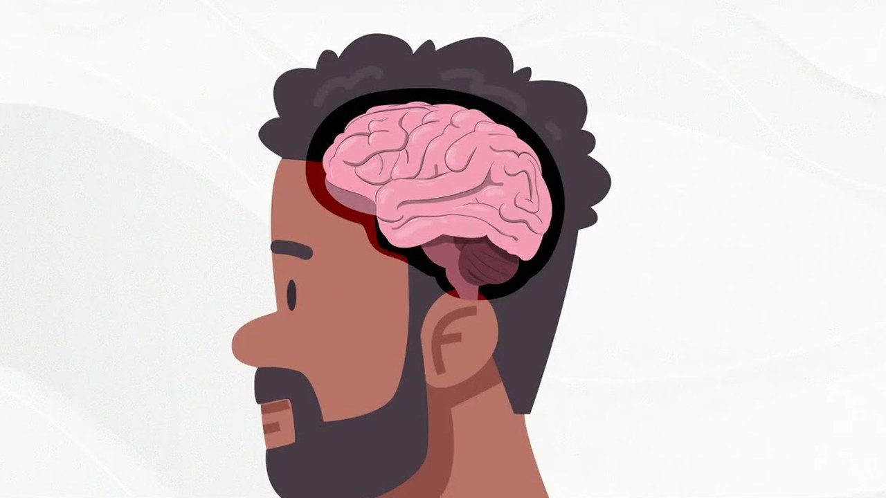 Understanding Huntington's Disease