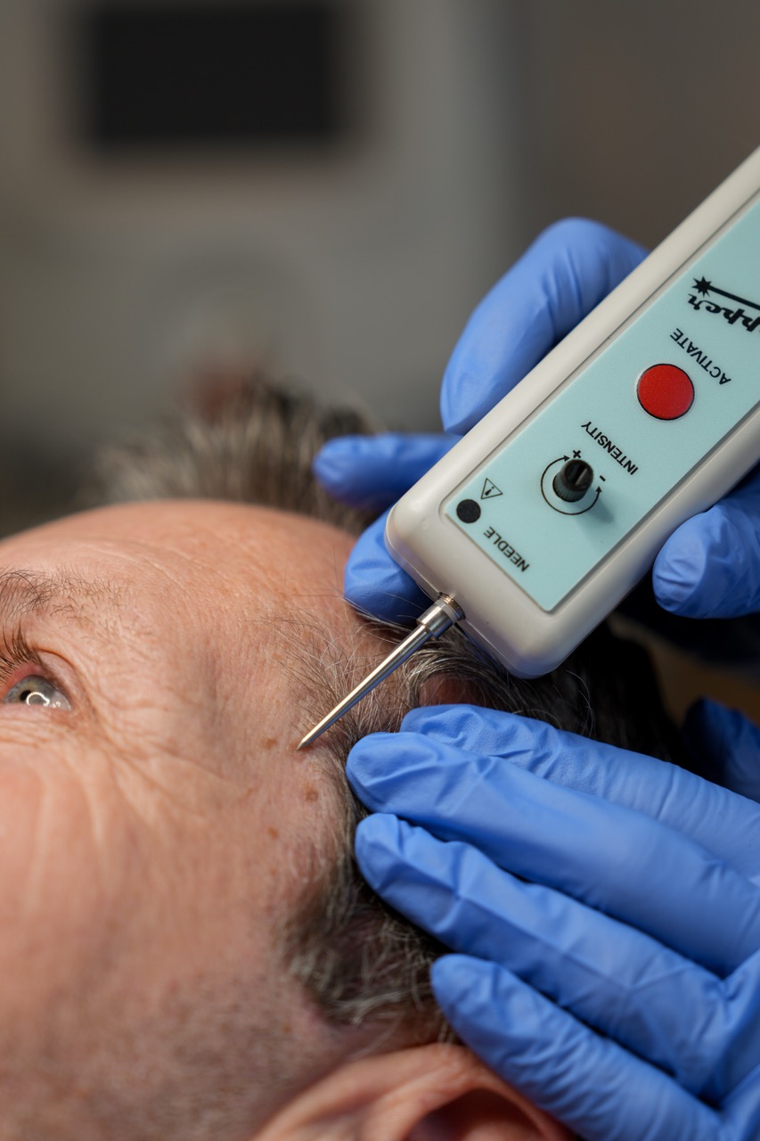 huidoneffenheden verwijderen door therapeut