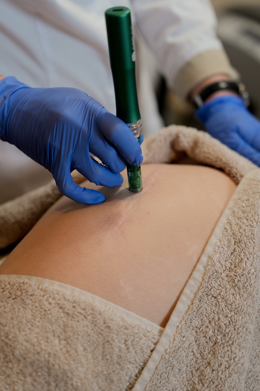 operatie wond op knie