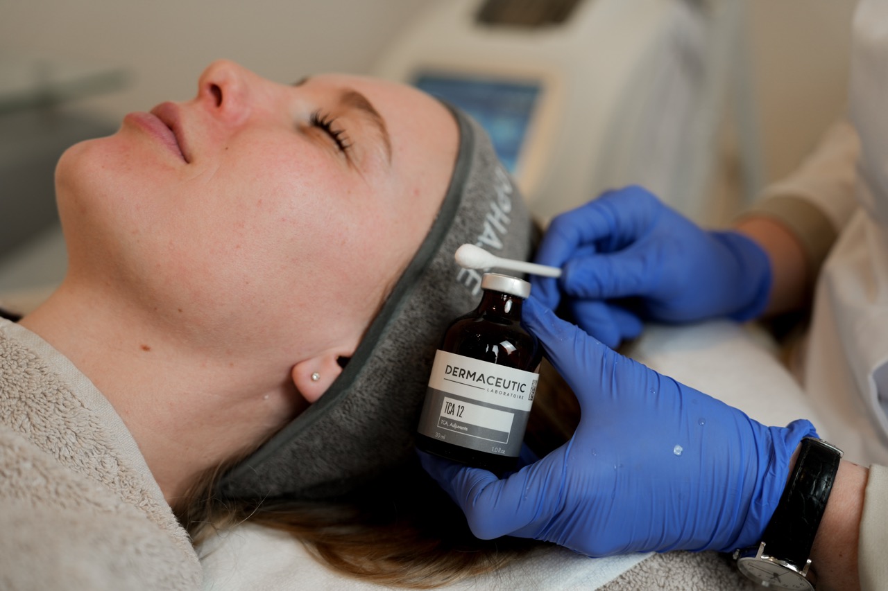 tca peeling tegen huidveroudering