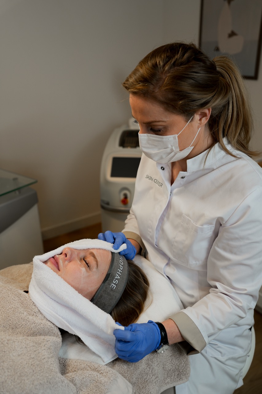 rosacea behandelen met een peeling