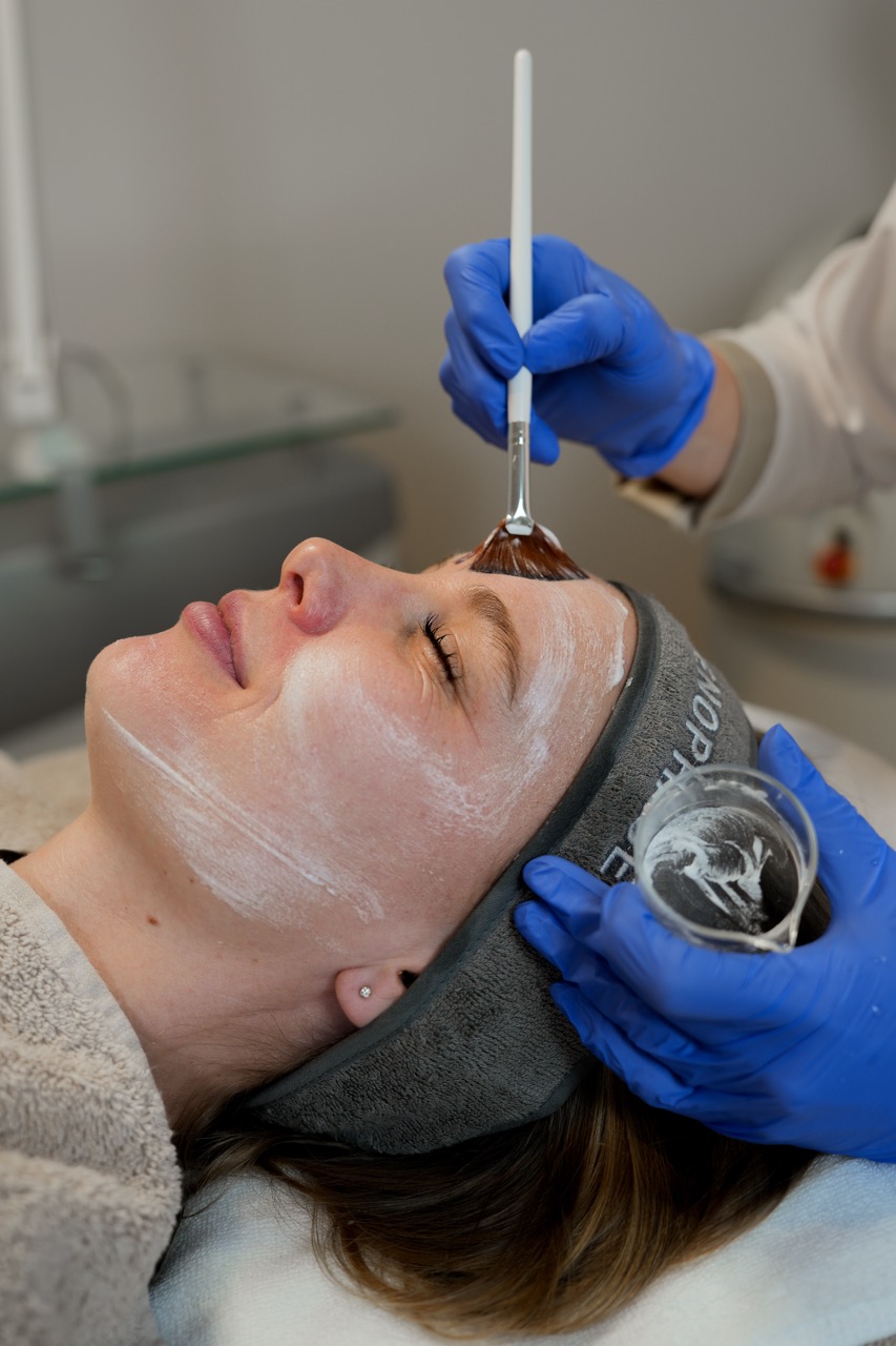 acne behandeling in Grave