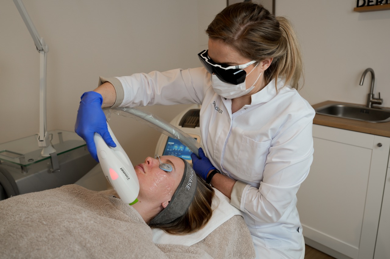 IPL Reclear behandeling tegen pigmentvlekken