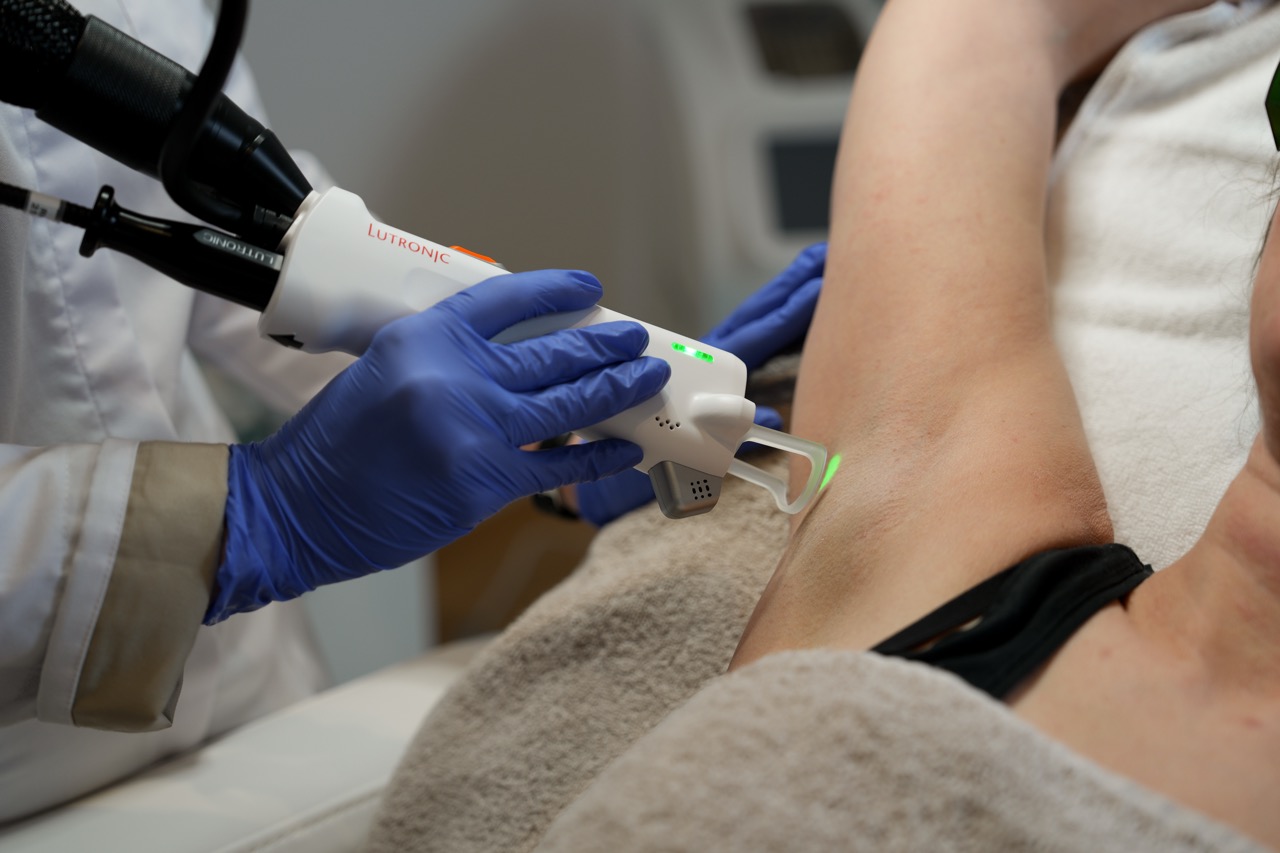 laserontharen van de oksel met de Clarity 2