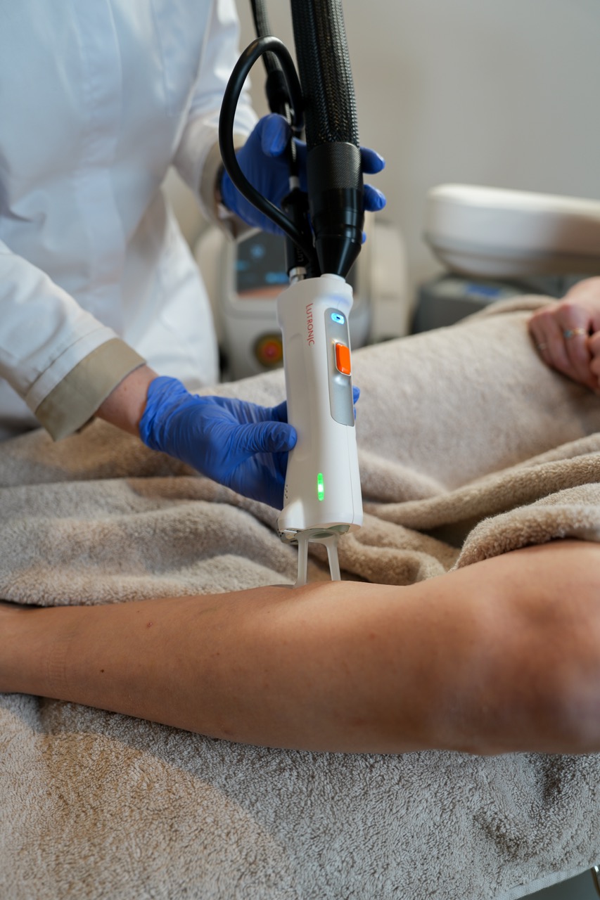 benen ontharen met de Alexandrite en Nd-YAG laser