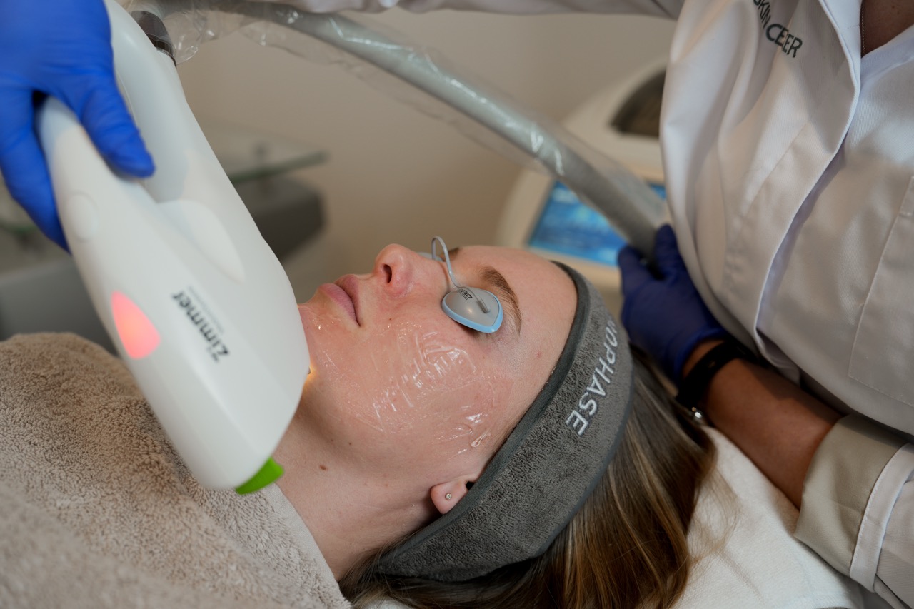 Reclear behandeling in huidkliniek