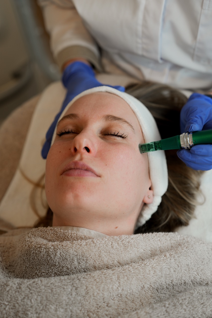 microneedling behandeling wang