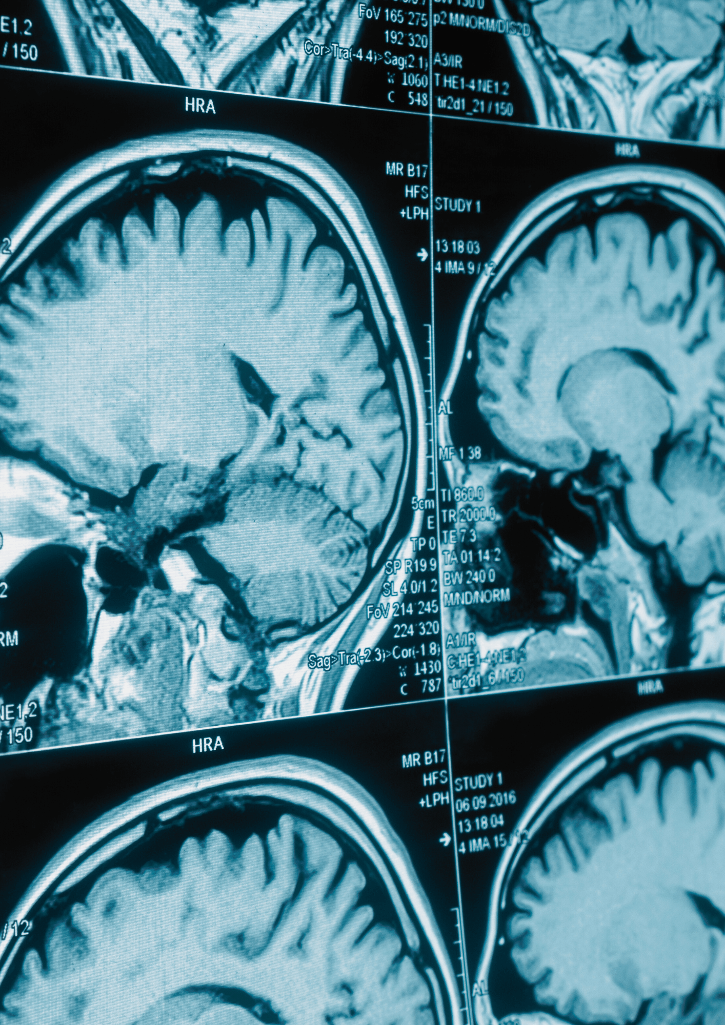 Multiple brain scans.