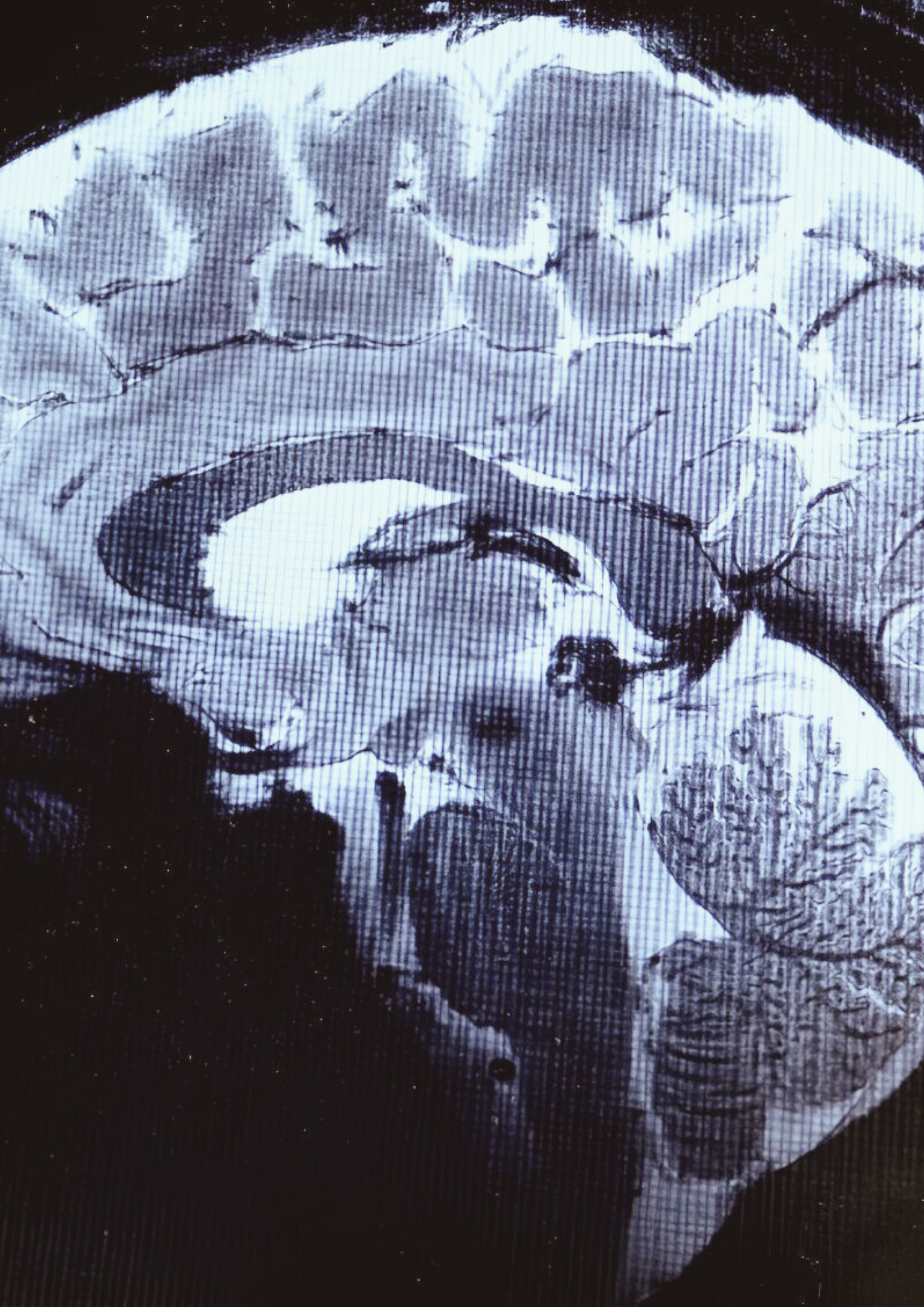 Brain scan.