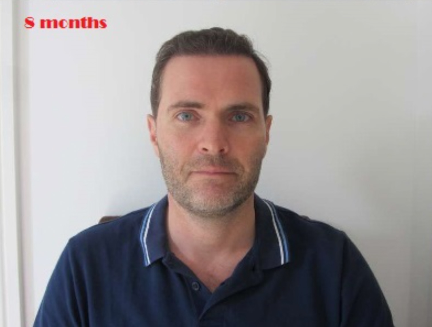 Man with short brown hair and a beard facing forward, wearing a navy polo shirt.