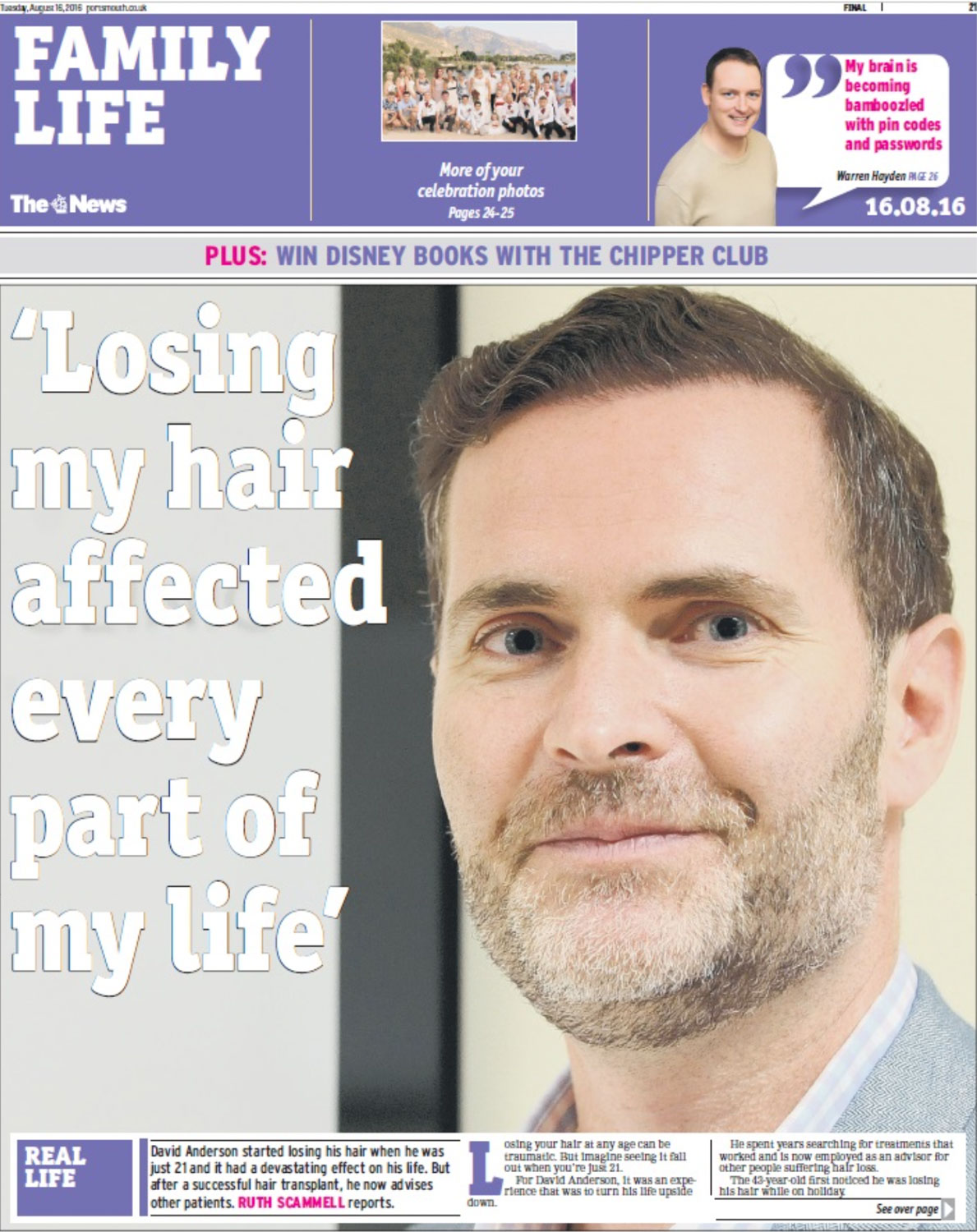 An article of David looking at the camera, next to a headline about hair loss impact.