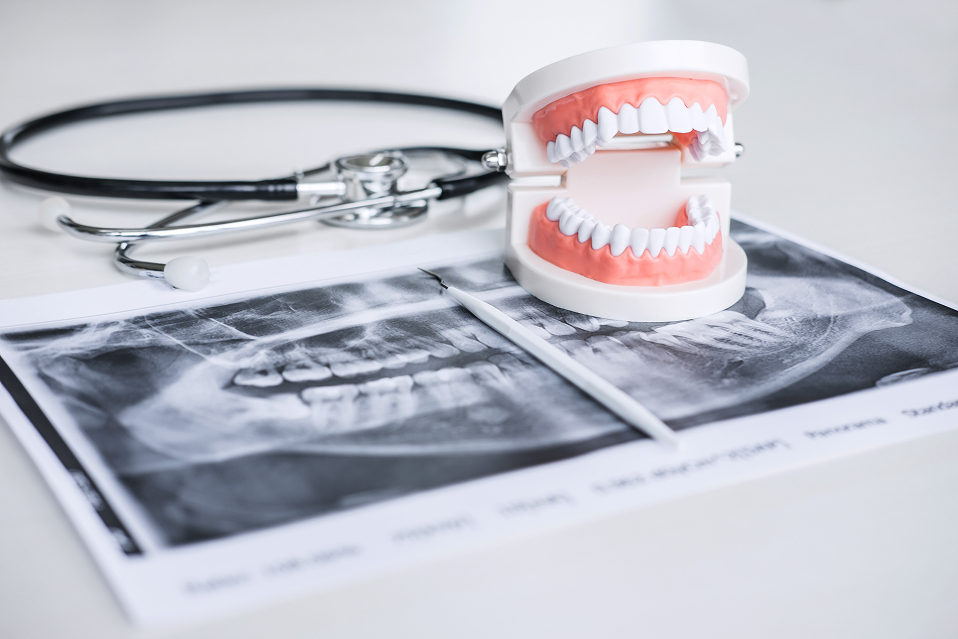 Dentist explaining dental X-ray results to a patient using a laptop during a consultation.