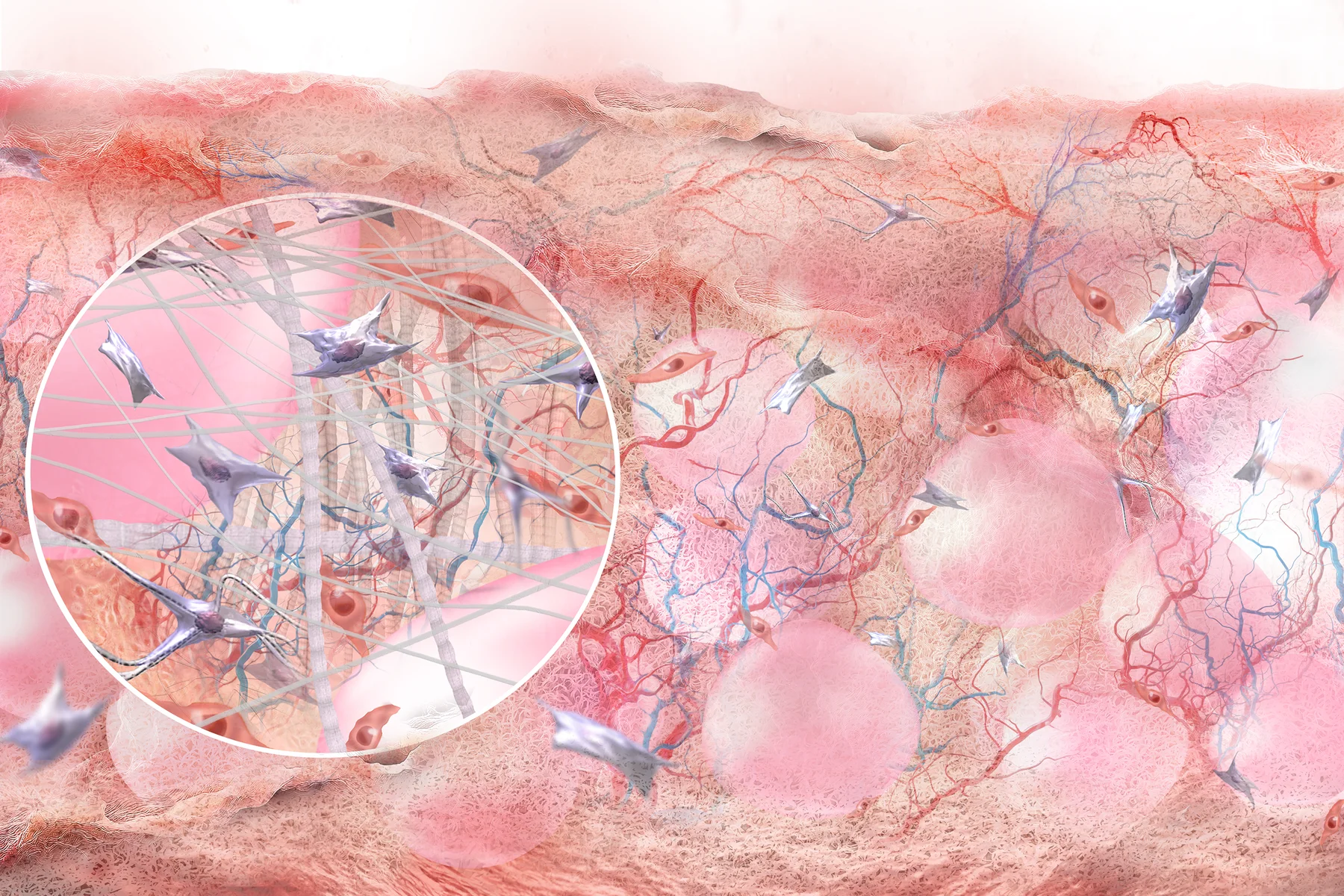 Illustration of DermiSphere hDRT at Day 7 showing cellular invasion and vascularization